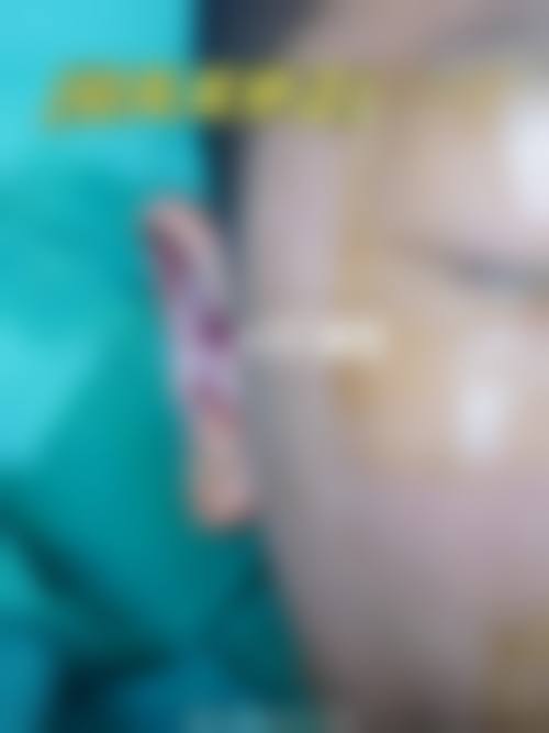 八、沈阳王衍整形医疗美容诊所真实的患者评价