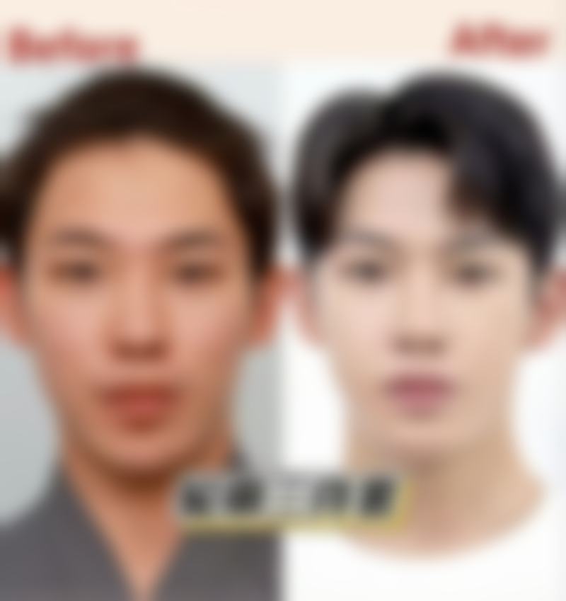 二、不同阶段烫伤疤痕的管理方案