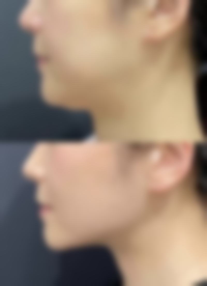 八、祛疤产品选择需谨慎