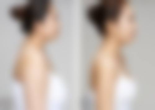 六、国内人民解放军第一五九医院整形美容中 心价格表