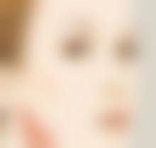 三、为什么40岁以后就变成双眼皮：改善眼部衰老形态方案