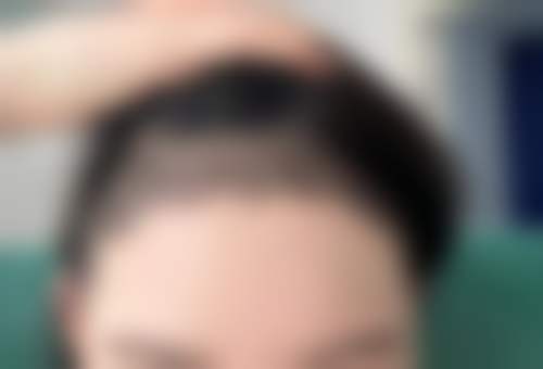 五、陈建君怎么预约？