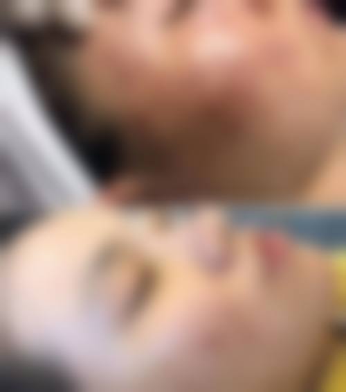 四、襄阳爱尚美医疗美容医院特色项目