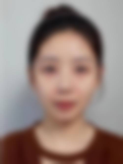 九、国内人民解放军第一五九医院整形美容中 心真实的患者评价