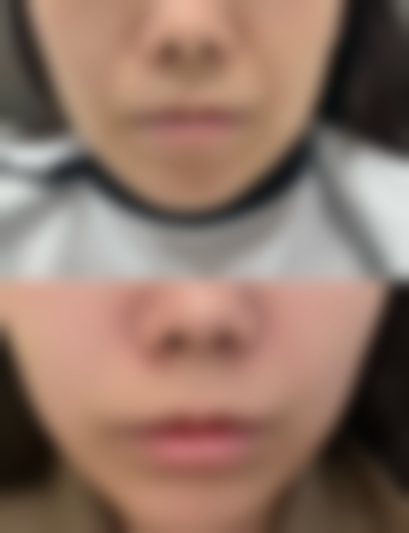 五、厦门馨容整形外科门诊部价格表