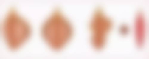 如何消除黑眼圈黑眼袋最有效？类型分析、日常护理与医美手段全攻略来了！ 