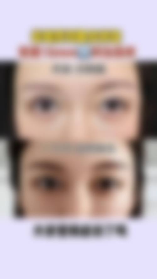 二、甘孜州人民医院整形美容科怎么样？