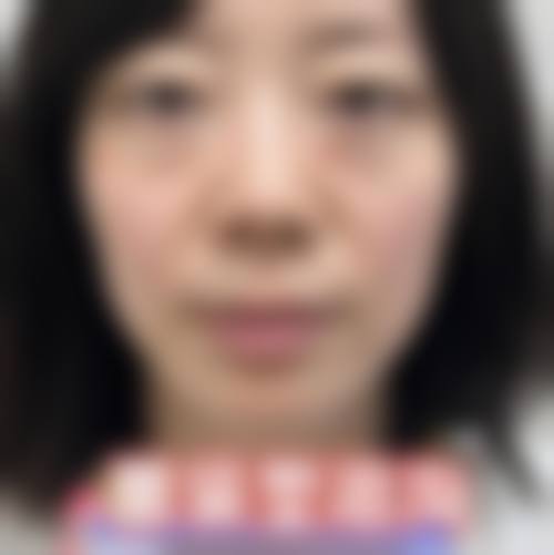 六、甘孜州人民医院整形美容科价格表