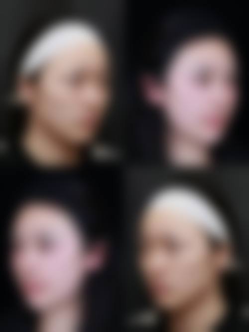 九、绵阳煌佳医疗整形美容诊所真实的患者评价