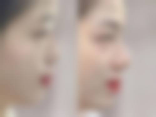 七、毕节四通医院医疗美容科预约方式