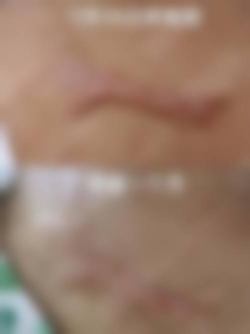 六、郭红磊真实的患者评价