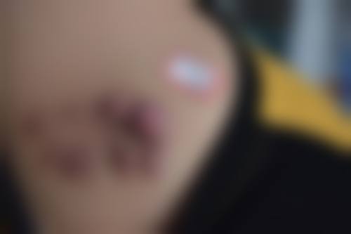 二、郭红磊擅长项目