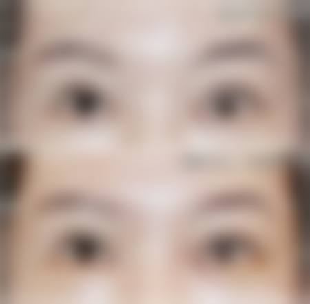 四、毕节四通医院医疗美容科特色项目