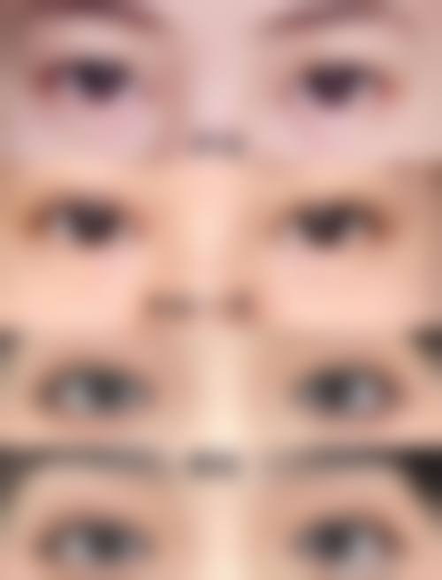 七、沈阳睿漾整形医院预约方式