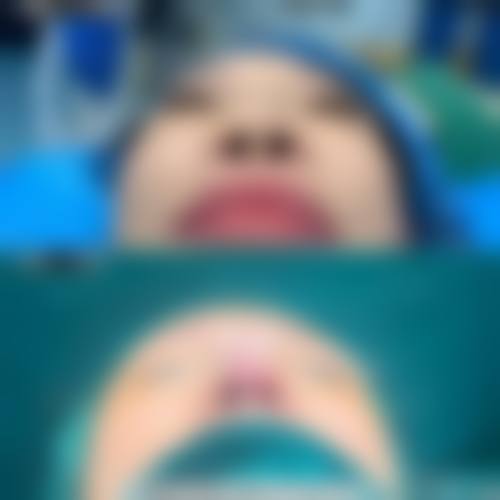 六、日本Sapho美容整形医院价格表