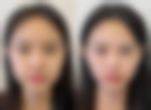 六、新乡好首先整形医院价格表