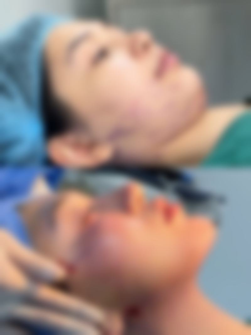 七、手术治疗红色疤痕的情况与注意