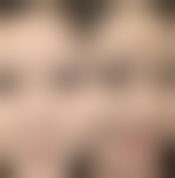 四、新乡好首先整形医院特色项目