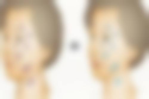 三、父母双眼皮会生出单眼皮孩子吗？隔代遗传因素影响