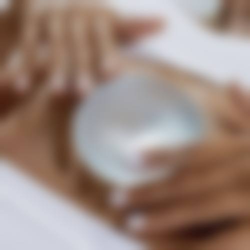 八、眉山华信医学整形美容真实的患者评价