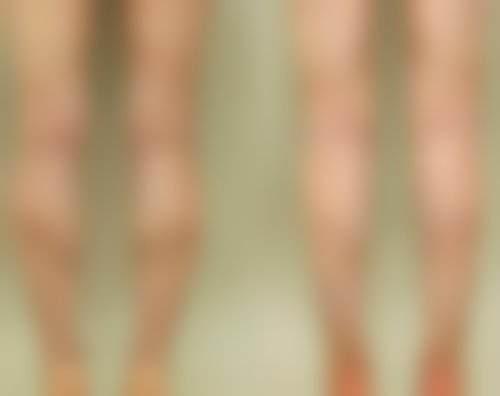 四、不同手术方式的对比