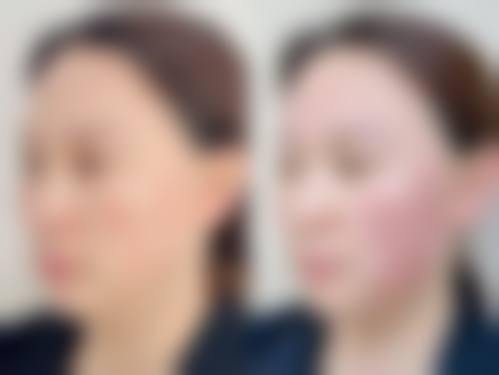 五、重庆曾曾医疗美容诊所价格表