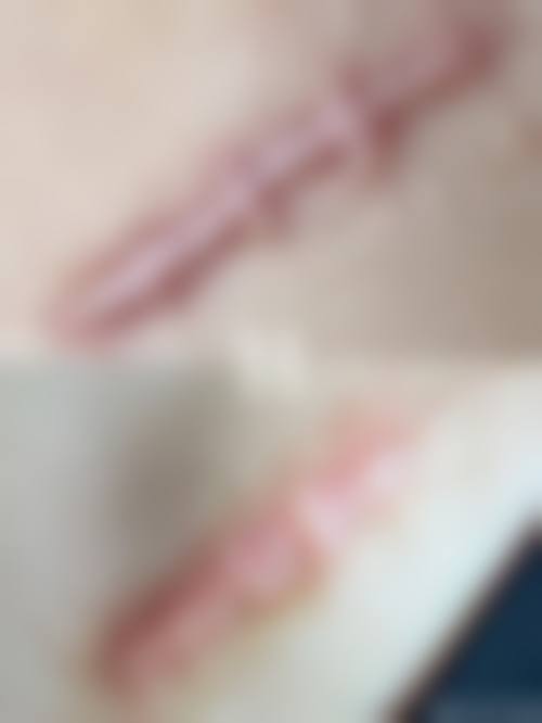 六、李欢梓真实的患者评价