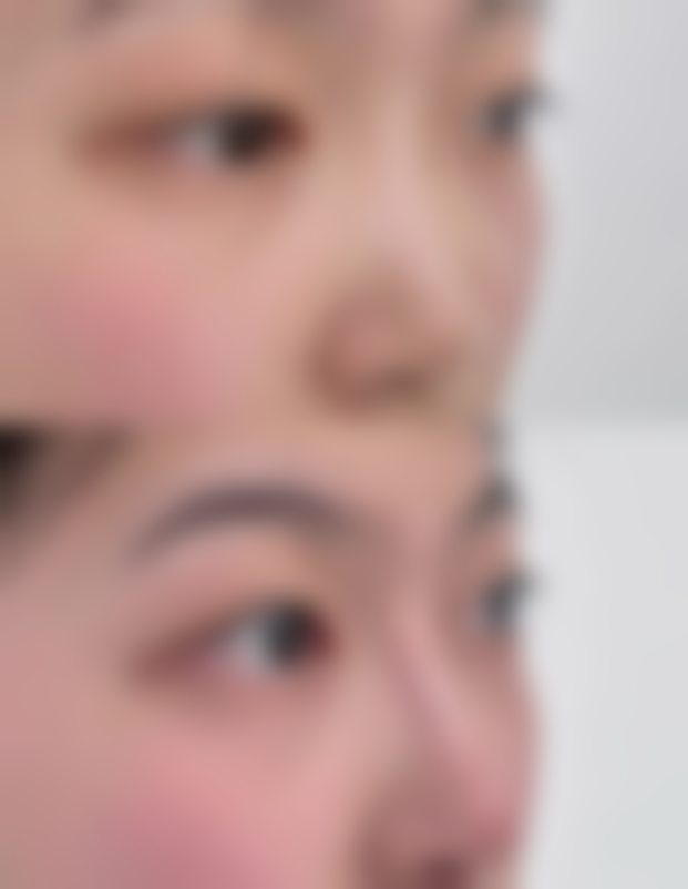 双眼皮可以做成内双吗？揭秘手术方法、效果及注意事项，附图片参考 