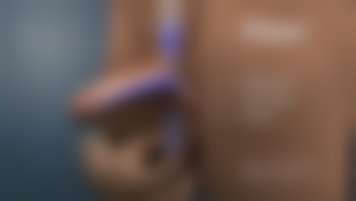 三、经常熬夜眼袋大的药物治疗方法