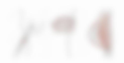 三、不同手术方式下割了双眼皮手术向上看的时长差异