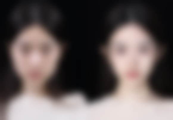 三、50岁做假体隆胸的风险