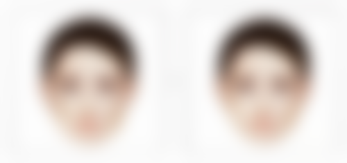 包皮手术环切钉子脱落需要辅助吗?