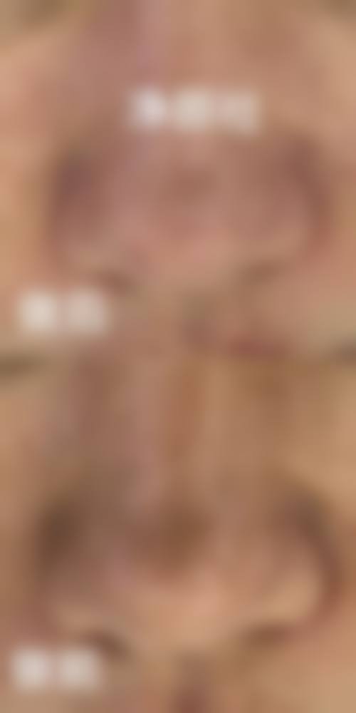 三、上海光泽医院整形美容科诊疗项目有哪些?