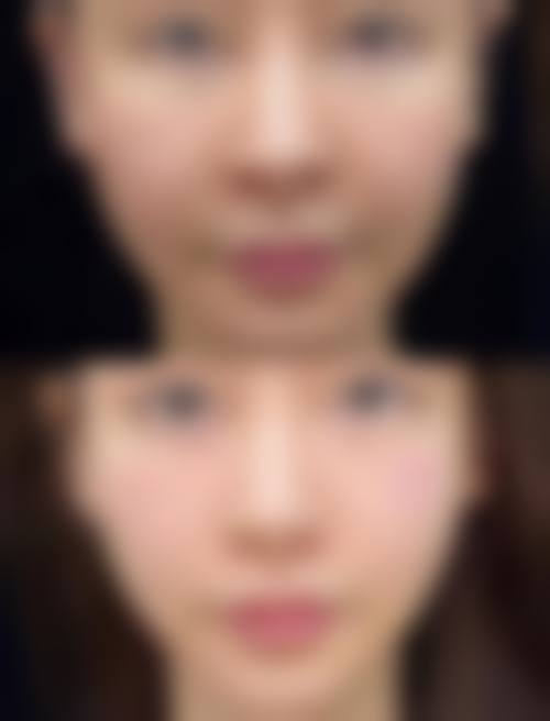 二、上海光泽医院整形美容科怎么样?