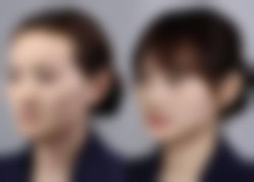 九、东莞星采医疗美容真实的患者评价