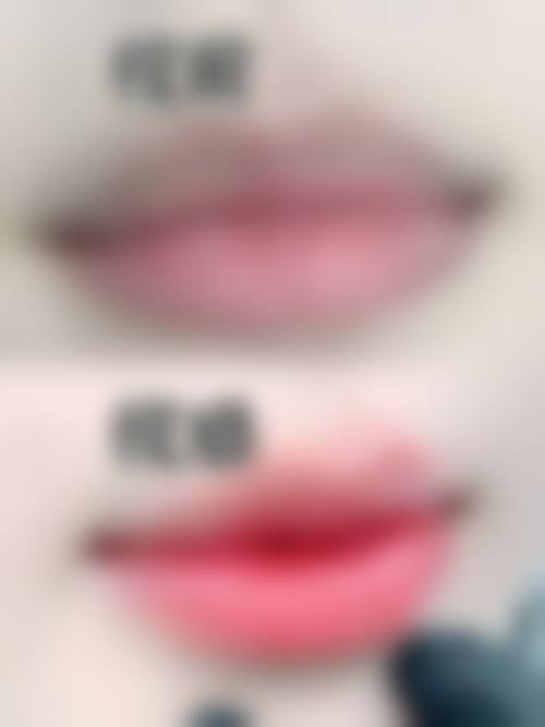 二、西安颜即铂澜医疗美容怎么样？