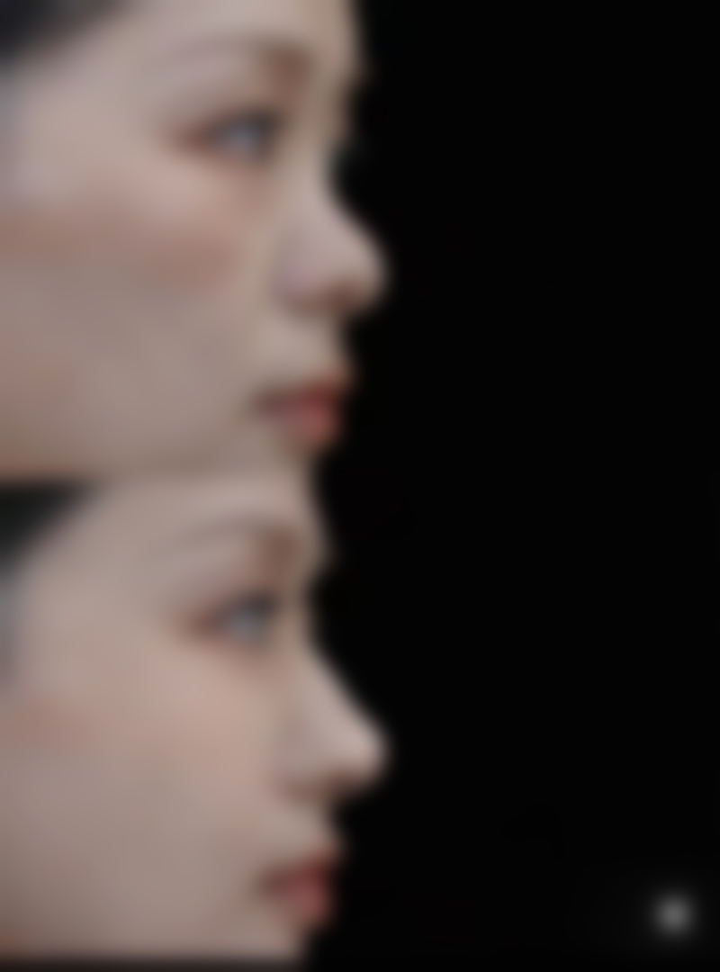 四、韩国德克莱斯整形医院特色项目