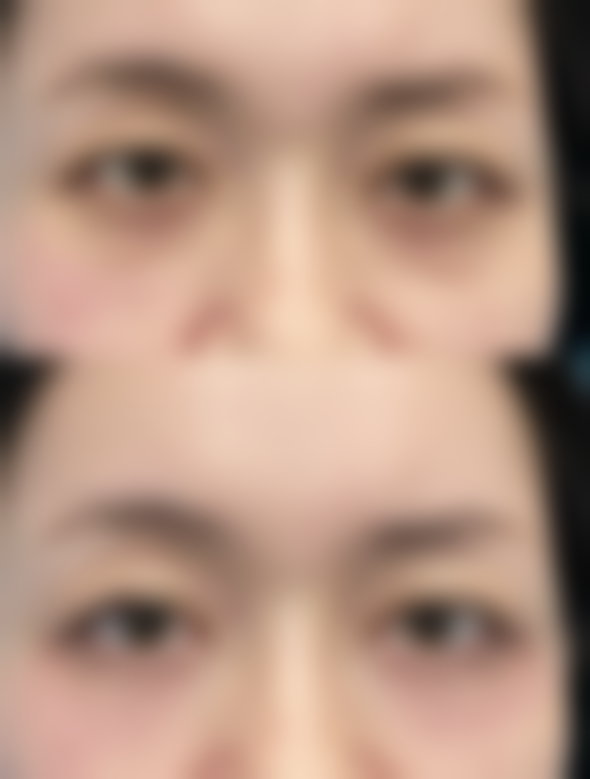 七、韩国德克莱斯整形医院预约方式