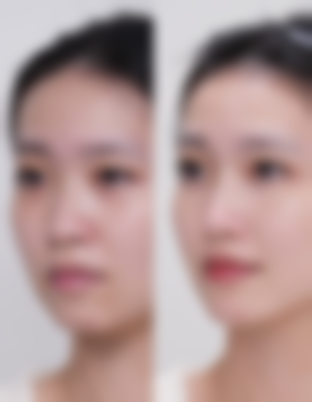 疤痕疙瘩不管它会怎么样？总结与建议