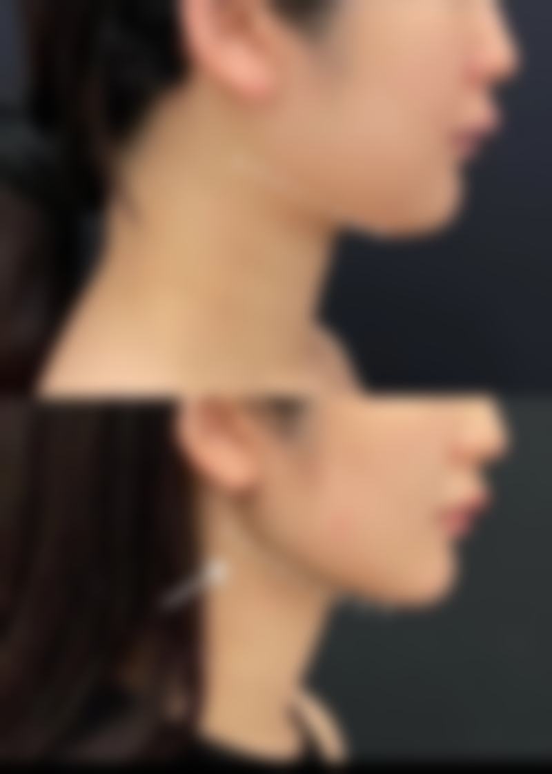 三、疤痕体质能完全治好吗之日常护理与预防