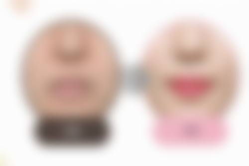 三、极射峰膨体的优势