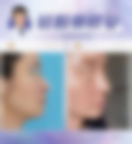 三、李春明技术优势