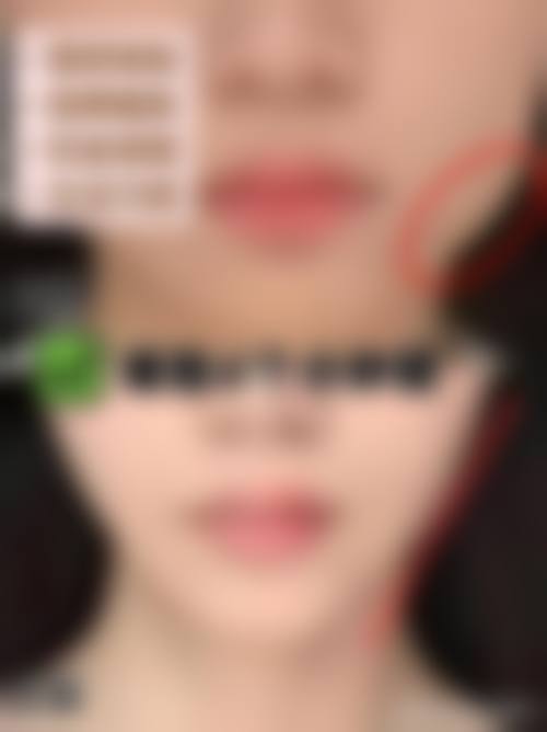 八、内蒙古林业总医院烧伤整形科真实的患者评价