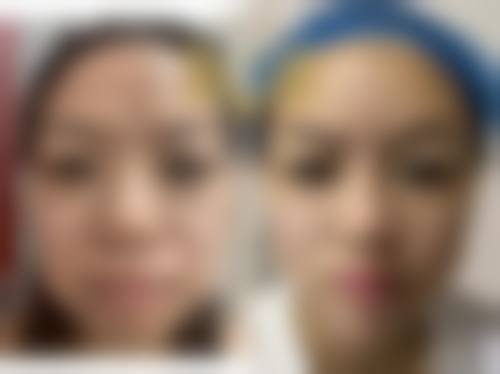 五、内蒙古林业总医院烧伤整形科价格表