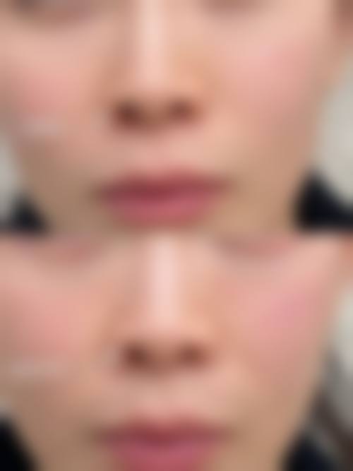 四、成都新华医院整形美容中 心特色项目