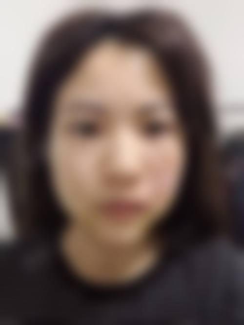 六、内蒙古林业总医院烧伤整形科地址及交通