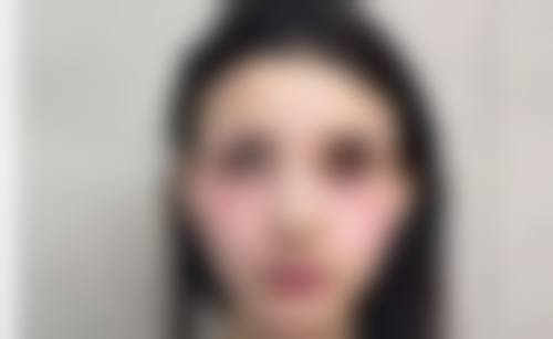 二、内蒙古林业总医院烧伤整形科怎么样？