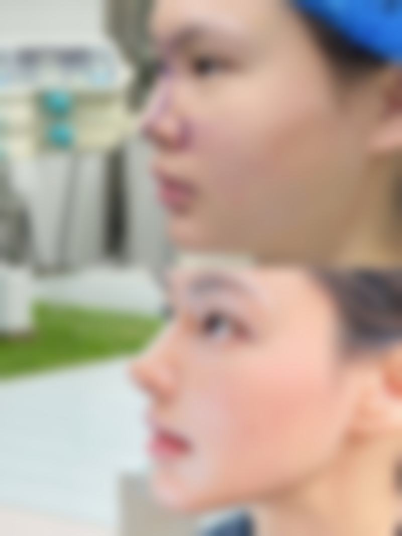 一、眼睛有眼袋黑眼圈的常见原因分析