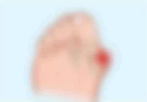 五、理性看待腰腹吸脂