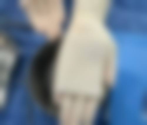 一、缝针后疤痕的类型与评估